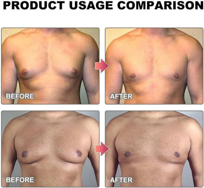 MenTherm Bee Venom Gynecomastia Heating Oil